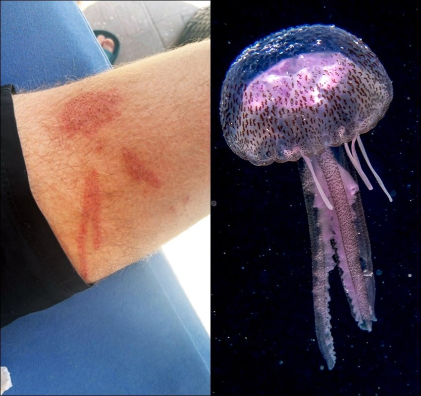 meduza opeklina tekst 170824 min